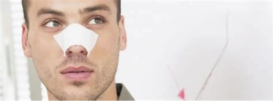 Close-up of nasal strips helping improve airflow during sleep.