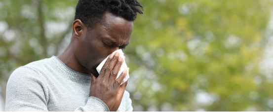 Nasal strips applied to a person's nose for improved airflow during allergy season.
