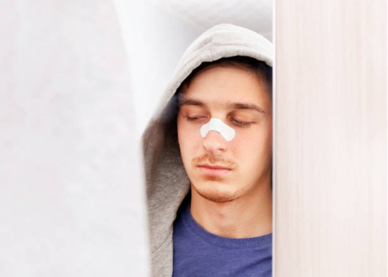 Close-up of sleep-type nasal strips designed for nighttime use