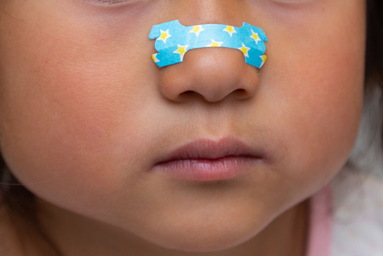 Child applying nasal strips to relieve nasal congestion.