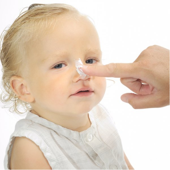 Close-up of nasal strips for kids designed to improve nighttime breathing.