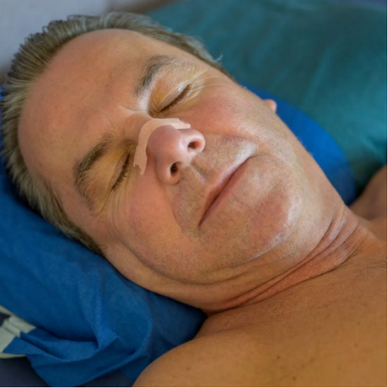 Nasal strip placed on a nose to improve airflow and reduce snoring.