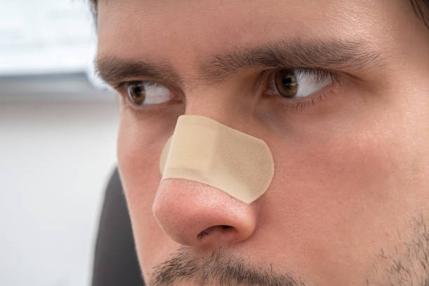 Close-up of a man wearing a beige nasal strip for better breathing.