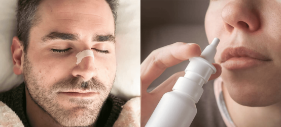 The boundary between the use of nasal strips and nasal sprays