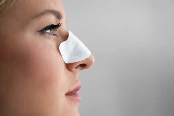 Close-up of nasal strips highlighting unobstructed nasal passage.